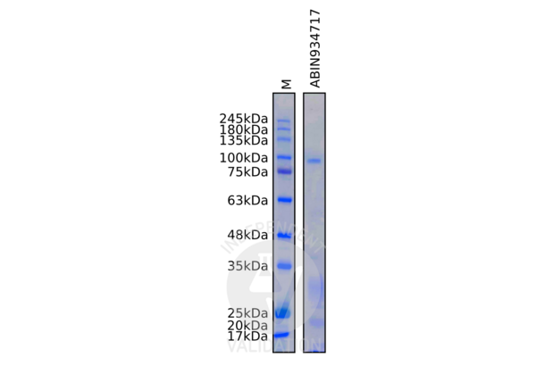 Thyroperoxidase Protein