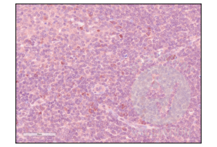 Immunohistochemistry validation image for anti-CD84 (CD84) (Internal Region) antibody (ABIN3187786) (CD84 antibody  (Internal Region))