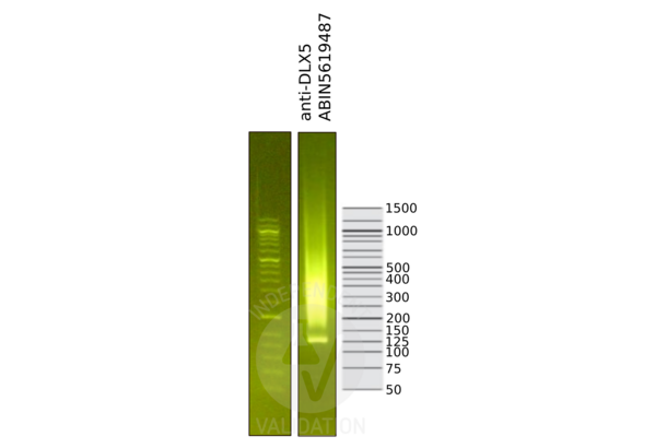 DLX5 antibody  (Center)