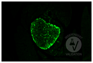 Glucagon antibody