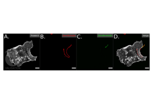 Immunofluorescence validation image for anti-Borrelia Burgdorferi antibody (ABIN236885) (Borrelia Burgdorferi antibody)