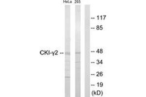 Western Blotting (WB) image for anti-Casein Kinase 1, gamma 2 (CSNK1G2) (AA 10-59) antibody (ABIN2889534) (Casein Kinase 1 gamma 2 antibody  (AA 10-59))