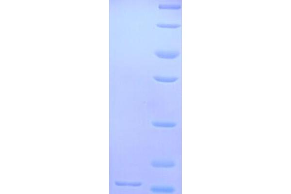 GLRa2 Protein (AA 27-143, Extracellular) (His tag)