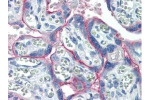 Human Placenta (formalin-fixed, paraffin-embedded) stained with c-Metat 15 µg/ml followed by biotinylated goat anti-rabbit IgG secondary antibody, alkaline phosphatase-streptavidin and chromogen. (c-MET antibody  (C-Term))