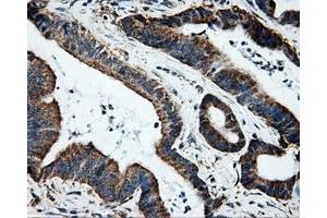 Immunohistochemical staining of paraffin-embedded Kidney tissue using anti-HSD17B10mouse monoclonal antibody. (HSD17B10 antibody)