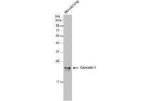 WB Image Caveolin 1 antibody [N1N3] detects Caveolin 1 protein by western blot analysis. (Caveolin-1 antibody  (N-Term))