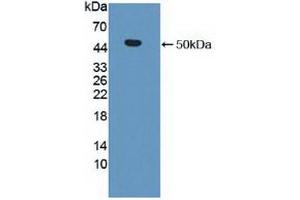 Western blot analysis of recombinant Human MMP19. (MMP19 antibody  (AA 98-508))