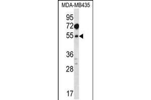 Western blot analysis in MDA-MB435 cell line lysates (35ug/lane). (MAT1A antibody  (N-Term))