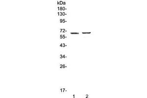 Western blot testing of 1) human placenta and 2) mouse testis lysate with RUNX1T1 antibody at 0. (RUNX1T1 antibody)