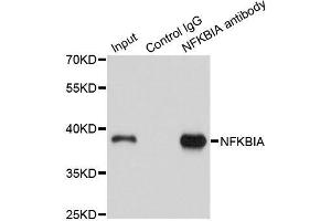 Immunoprecipitation analysis of 150ug extracts of A549 cells using 3ug NFKBIA antibody. (NFKBIA antibody  (AA 1-317))