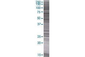 GRPEL2 transfected lysate. (GRPEL2 293T Cell Transient Overexpression Lysate(Denatured))