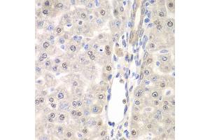 Immunohistochemistry of paraffin-embedded rat liver using DTX2 antibody (ABIN6127799, ABIN6139853, ABIN6139854 and ABIN6223266) at dilution of 1:100 (40x lens). (DTX2 antibody  (AA 1-280))