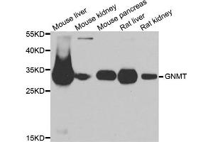 Western blot analysis of extracts of various cell lines, using GNMT antibody. (GNMT antibody)