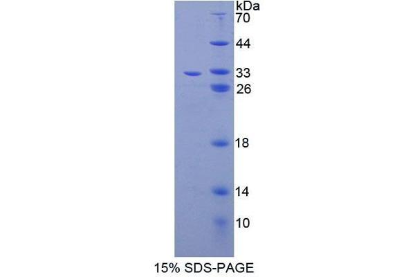 ABCB9 Protein (AA 504-766) (T7 tag,His tag)