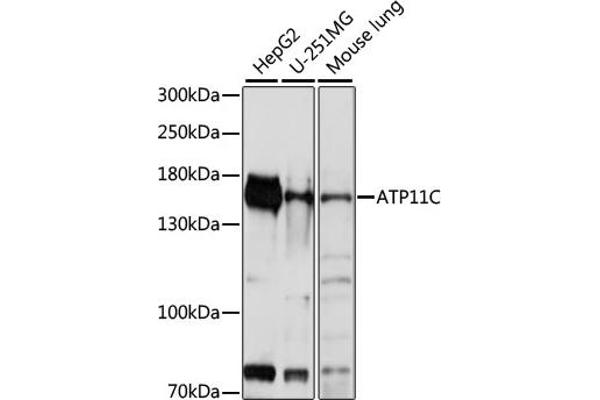 ATP11C antibody  (AA 430-650)