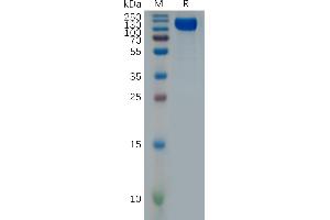 Human IF Protein, hFc Tag on SDS-PAGE under reducing condition. (IFNAR1 Protein (AA 28-436) (Fc Tag))