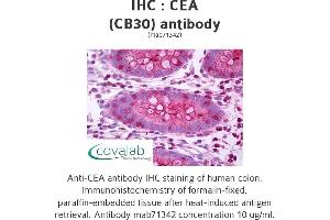 Image no. 1 for anti-Carcinoembryonic Antigen Gene Family (CEA) antibody (ABIN1722851) (CEA antibody)