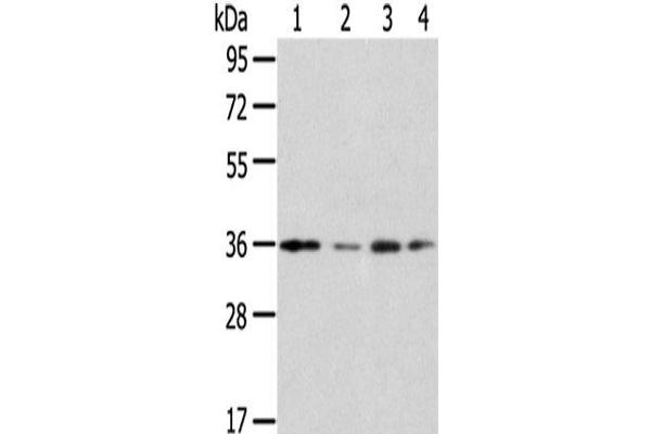 Homeobox D13 antibody