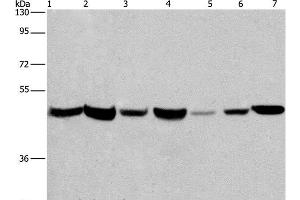 Western Blot analysis of Human placenta and fetal liver tissue, PC3, 231, Hela, HepG2 and A549 cell using APMAP Polyclonal Antibody at dilution of 1:300 (APMAP antibody)