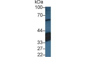 Detection of RLBP1 in Porcine Eye lysate using Polyclonal Antibody to Retinaldehyde Binding Protein 1 (RLBP1) (RLBP1 antibody)