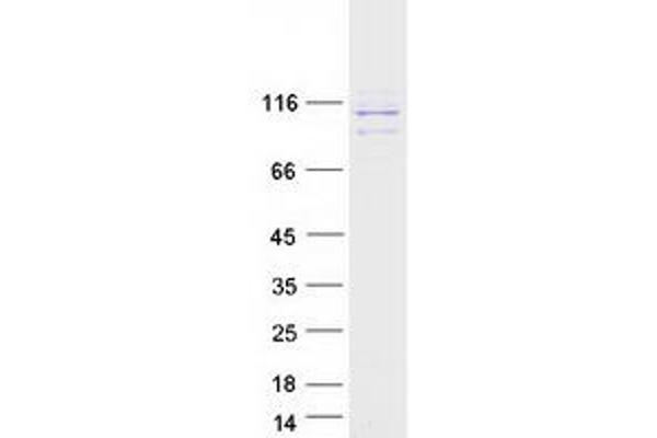 RRBP1 Protein (Transcript Variant 1) (Myc-DYKDDDDK Tag)