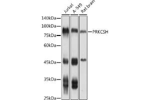 Western blot analysis of extracts of various cell lines, using PRKCSH antibody (ABIN1682300, ABIN3018458 and ABIN7101614) at 1:1000 dilution. (PRKCSH antibody)