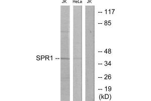Western Blotting (WB) image for anti-Psoriasis Susceptibility 1 Candidate 2 (PSORS1C2) (C-Term) antibody (ABIN1849648) (SPR1 antibody  (C-Term))