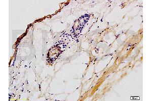 Formalin-fixed and paraffin embedded rat skin tissue labeled with Anti-CK2 Polyclonal Antibody,Unconjugated (ABIN730813) at 1:200 followed by conjugation to the secondary antibody and DAB staining (Keratin 2 antibody  (AA 535-638))