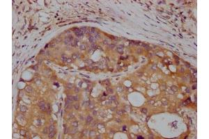 Immunohistochemistry (IHC) image for anti-Met Proto-Oncogene (MET) antibody (ABIN7127616)