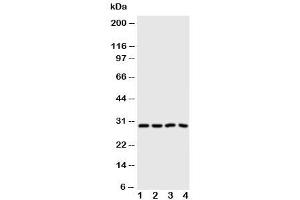 Western blot testing of Carbonic Anhydrase III antibody and Lane 1:  SMMC-7721 (CA3 antibody  (N-Term))