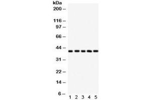 Western blot testing of 1) human HeLa, 2) human A549, 3) human U87, 4) rat brain and 5) rat liver lysate with HLA-C antibody. (HLA-C antibody)