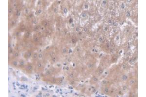 DAB staining on IHC-P; Samples: Human Liver Tissue (TREX1 antibody  (AA 6-369))