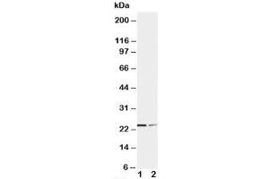 Western blot testing of SOCS1 antibody and Lane 1:  HT1080;  2: COLO320 cell lysate. (SOCS1 antibody  (C-Term))