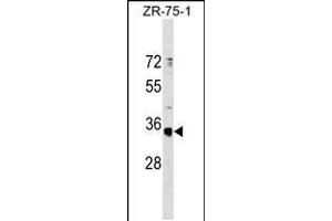 Western blot analysis in ZR-75-1 cell line lysates (35ug/lane). (OR51G1 antibody  (C-Term))