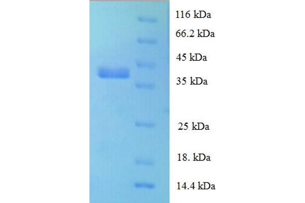 RPL28 Protein (AA 2-137) (GST tag)