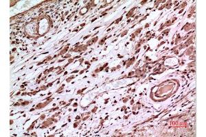 Immunohistochemistry (IHC) analysis of paraffin-embedded Human Brain, antibody was diluted at 1:100. (p53 antibody  (Tyr216))