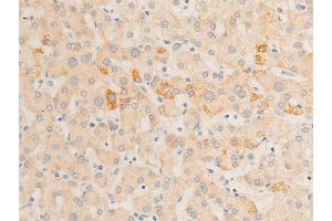 Immunohistochemistry (IHC) image for anti-Nuclear Factor-kB p65 (NFkBP65) (pSer536) antibody (ABIN6255402)