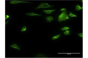 Immunofluorescence of monoclonal antibody to HDAC6 on HeLa cell. (HDAC6 antibody  (AA 1-1063))