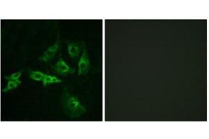 Immunofluorescence (IF) image for anti-Gonadotropin-Releasing Hormone Receptor (GNRHR) (Internal Region) antibody (ABIN1852968) (GNRHR antibody  (Internal Region))