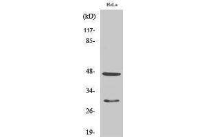 Western Blotting (WB) image for anti-Cathepsin D (CTSD) (Internal Region) antibody (ABIN3183692) (Cathepsin D antibody  (Internal Region))