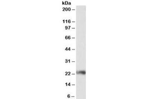 Western blot testing of Jurkat lysate with CD3G antibody at 0. (CD3G antibody)