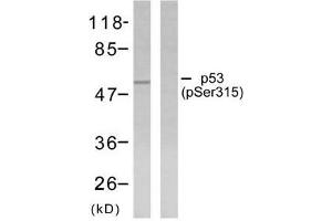 Western blot analysis of extracts from ovary cancer cells using p53 (phosphor-Ser315) antibody (E011100). (p53 antibody  (pSer315))