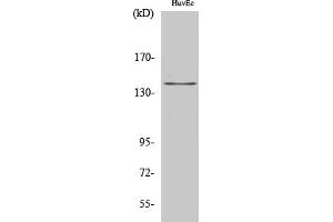 Western Blot analysis of HuvEc cells using Amyloid-β Polyclonal Antibody diluted at 1:2000. (beta Amyloid antibody)