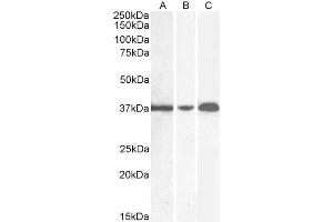 Western Blotting (WB) image for anti-Glyceraldehyde-3-Phosphate Dehydrogenase (GAPDH) (C-Term) antibody (ABIN185240)