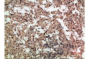 Immunohistochemical analysis of paraffin-embedded human-spleen, antibody was diluted at 1:200 (PF4 antibody  (AA 51-100))