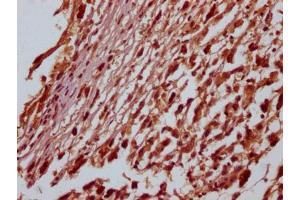 Immunohistochemistry (IHC) image for anti-SRY (Sex Determining Region Y)-Box 1 (SOX1) antibody (ABIN7127821)