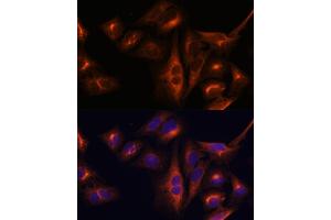 Immunofluorescence analysis of U-2 OS cells using Osteocalcin antibody (ABIN6134565, ABIN6137546, ABIN6137547 and ABIN6221793) at dilution of 1:100. (Osteocalcin antibody  (AA 1-100))