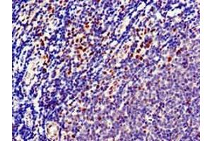Immunohistochemistry of paraffin-embedded human lymph node tissue using ABIN7150733 at dilution of 1:100 (Mps1 antibody  (AA 370-492))
