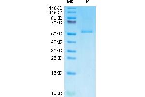 Monkeypox virus E8L on Tris-Bis PAGE under reduced condition. (MPXV E8L (AA 1-275) protein (His tag))