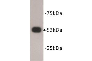 Western Blotting (WB) image for anti-Tumor Protein P53 (TP53) antibody (ABIN1854958) (p53 antibody)